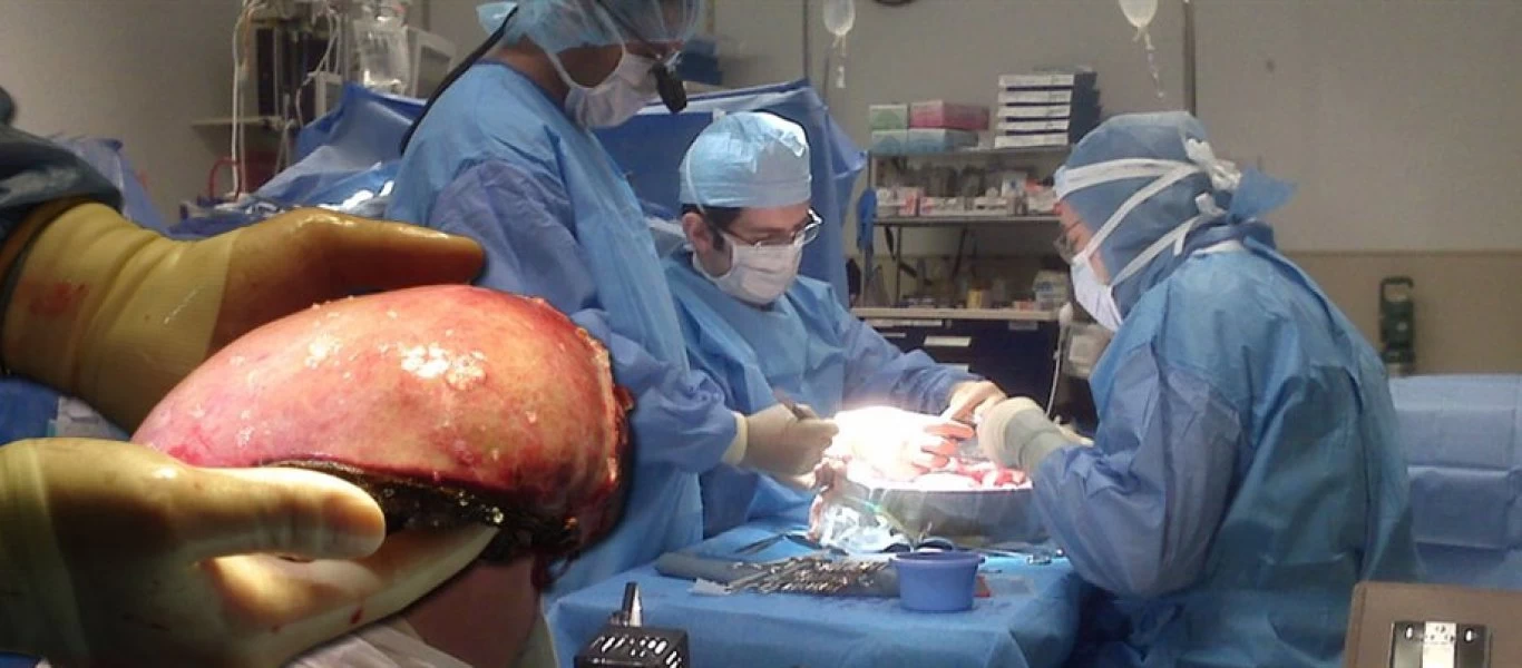 Τουρκία: Έχει μετατραπεί σε «σφαγείο» μεταναστών - Κάνει εμπόριο οργάνων - Βοηθούν και Αλβανοί τρομοκράτες (φώτο)